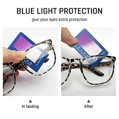 TOREGE Safety Glasses, Safety Goggles Protective Eyewear With Anti-Fog And Anti-Blue Light Lenses For Nurse Women (Leopard & Yellow) - color: Leopard & Yellow